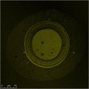 Confocal micrograph by Chern Leing Lee