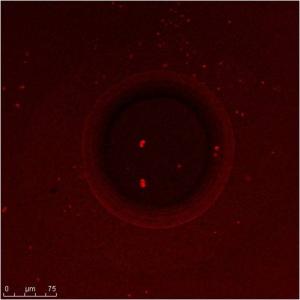 Confocal micrograph by Chern Leing Lee