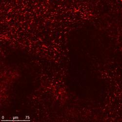 CNT suspension in agarose at low magnification