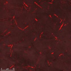 CNT suspension in agarose at high magnification