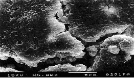 SEM image of yeast cells on membrane surface
