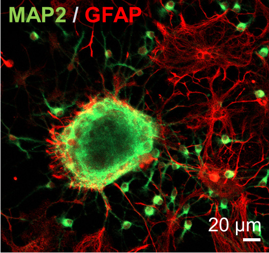 Image from Pas et al of neurospheres stained for astrocytes and neurons
