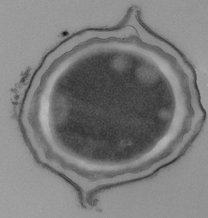 TEM of a Bacillus megaterium QM B1551 spore