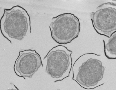 TEM of germinating Bacillus megaterium spores