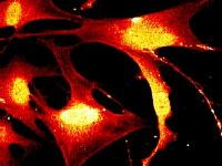 Live cell imaging: fluorescing neuron cells  (Parkinson's disease) under fluorescent  microscopy.