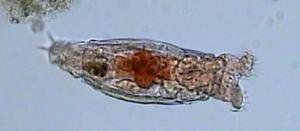 The bdelloid rotifer Philodina roseola