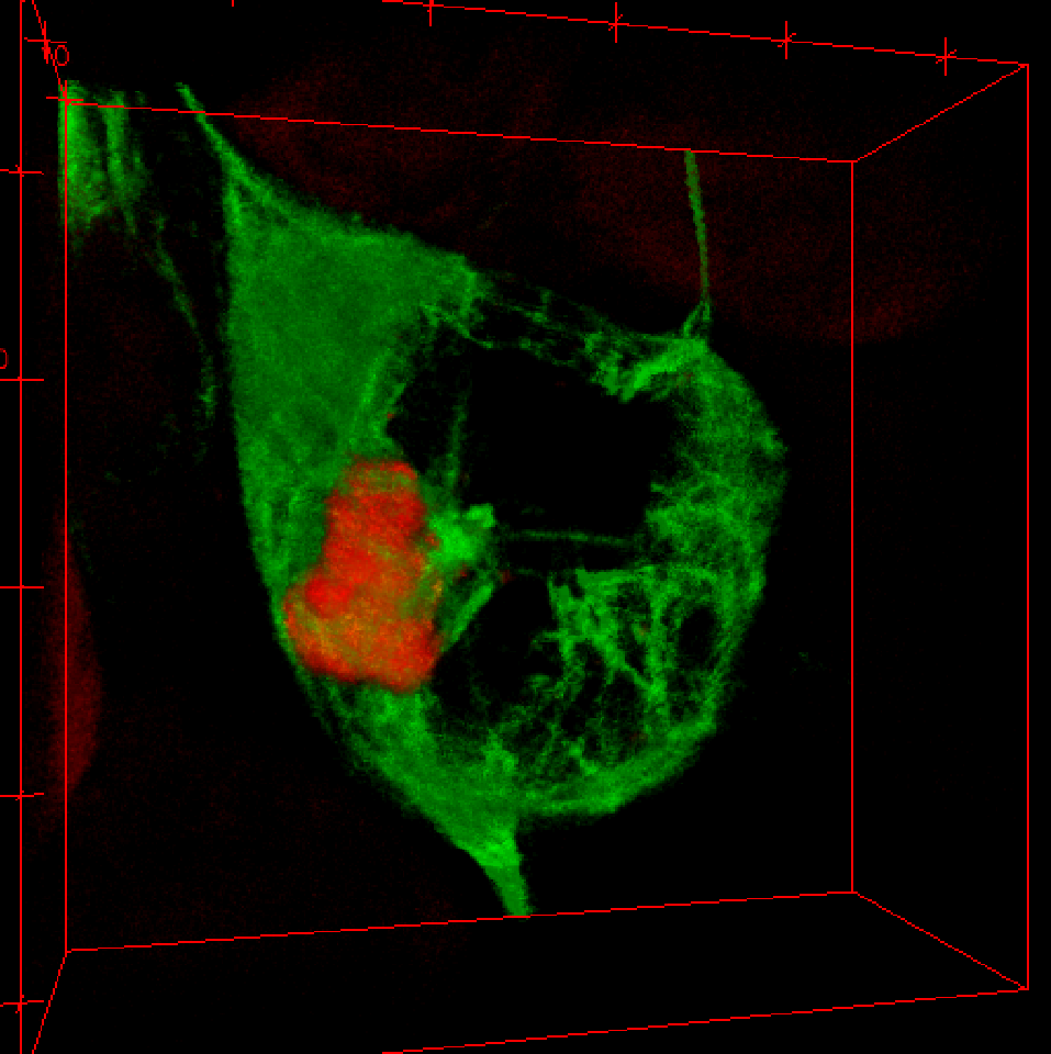 A cell expressing polyQ (red), an aggregsome deposits next to microtubule-organising centre (MTOC, green).