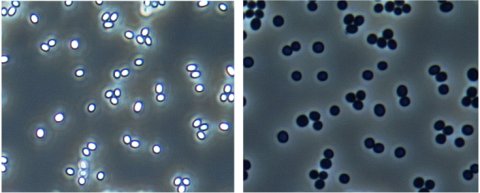 Phase contrast microscopy images of dormant and germinated Bacillus megaterium spores