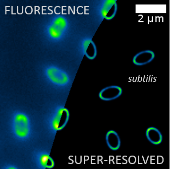 Fluorescent Shell Localisation in Therapeutic Bacteria Spores